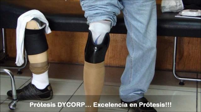 Transtibial vs. Transradial Prostheses: Understanding Upper and Lower Limb Differences